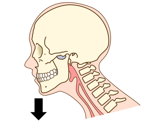 ストレートネック