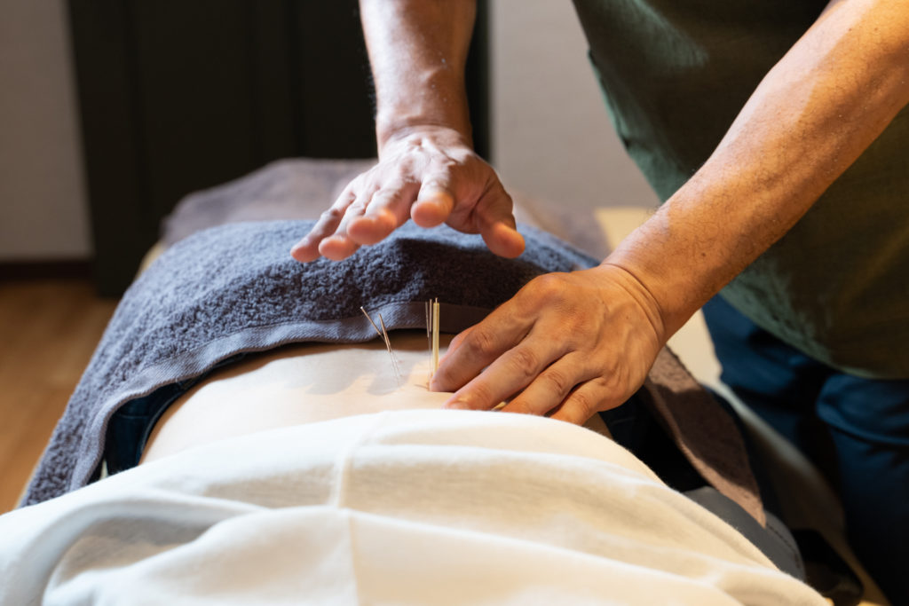 鍼灸の施術